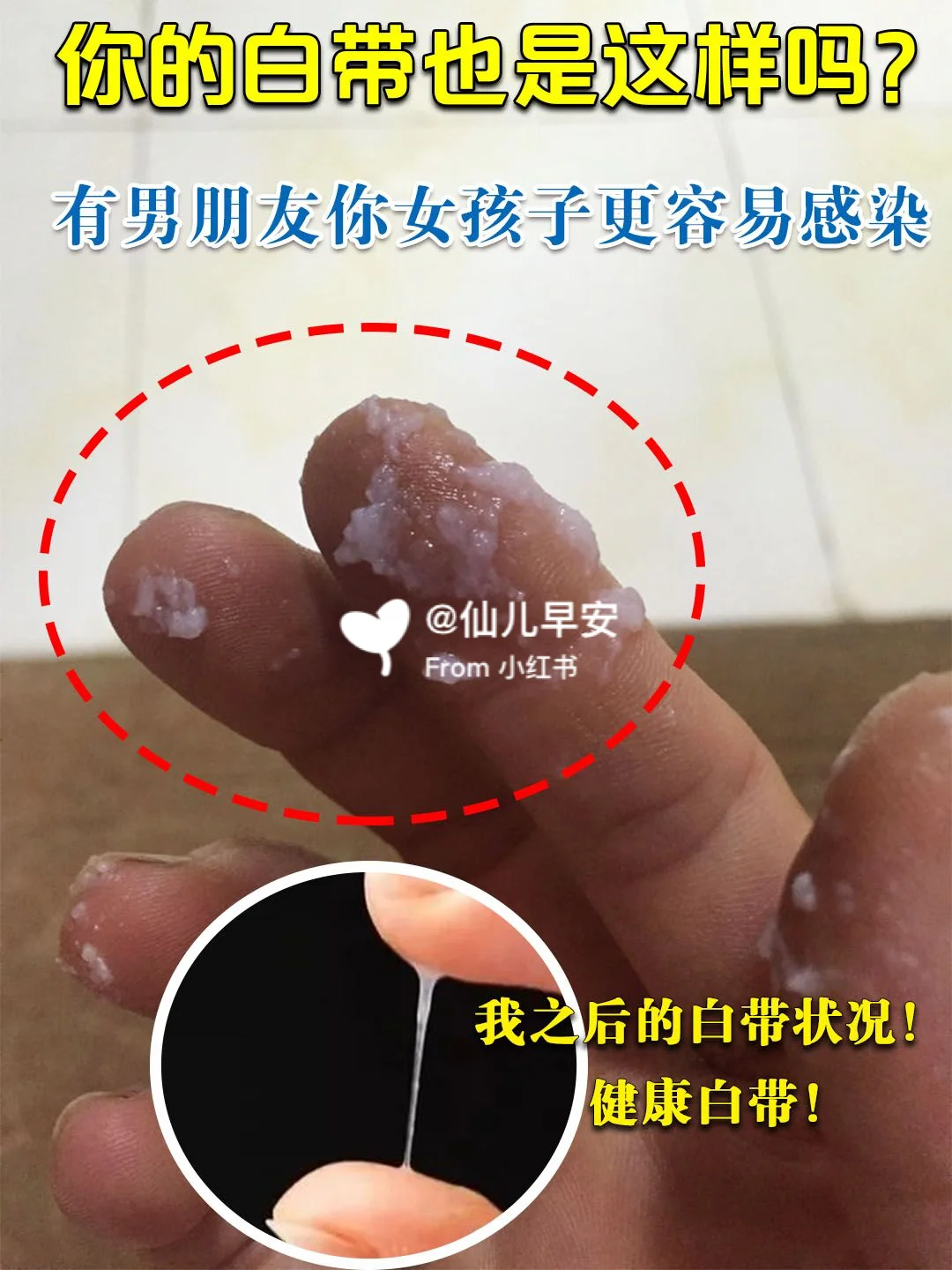 女生下面痒是怎么回事原因,深度剖析文章，专业解读，值得一读！
